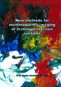 Cover of New methods for multimodal MS imaging of histological tissue sections