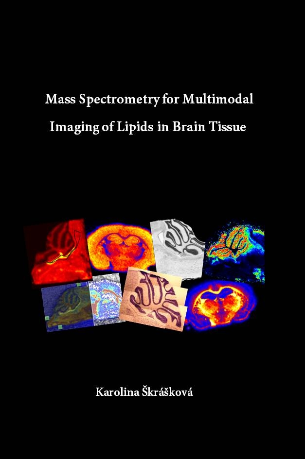 Cover of Mass Spectrometry for Multimodal Imaging of Lipids in Brain Tissue