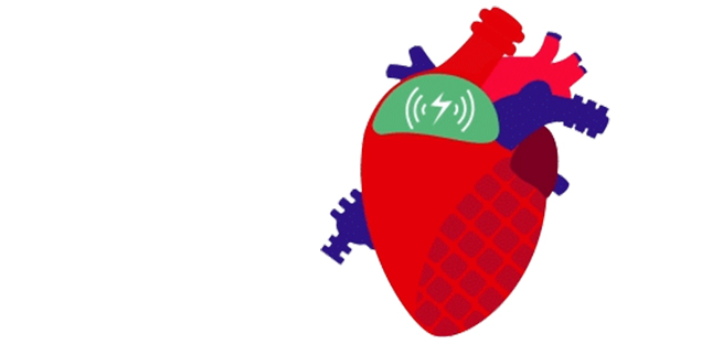 Hybrid Heart shortlisted for £30 million research grant - AMOLF